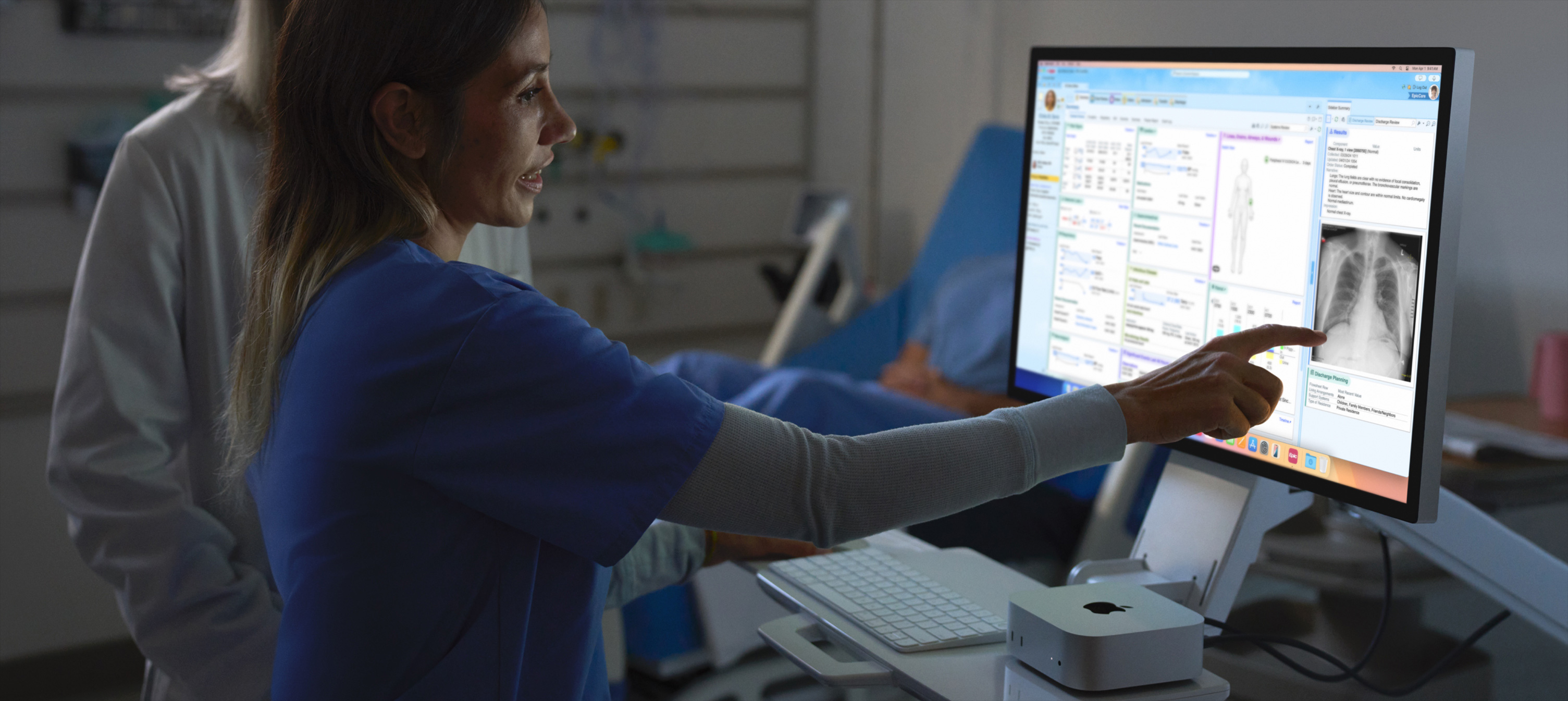 Bild på en sjuksköterska som pekar på patientens röntgenbild på en iMac.
