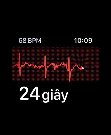 Ứng dụng ECG, số nhịp mỗi phút ở góc trên cùng bên phải, dòng thể hiện nhịp, hẹn giờ